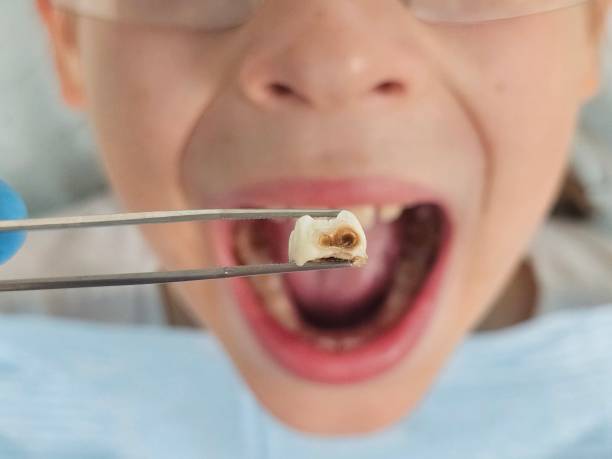 Best Urgent Dental Care for Toothache in East Bernard, TX
