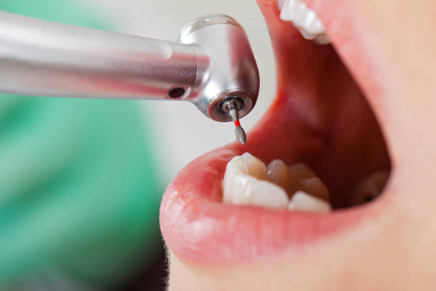 East Bernard, TX Emergency Dentist Pros
